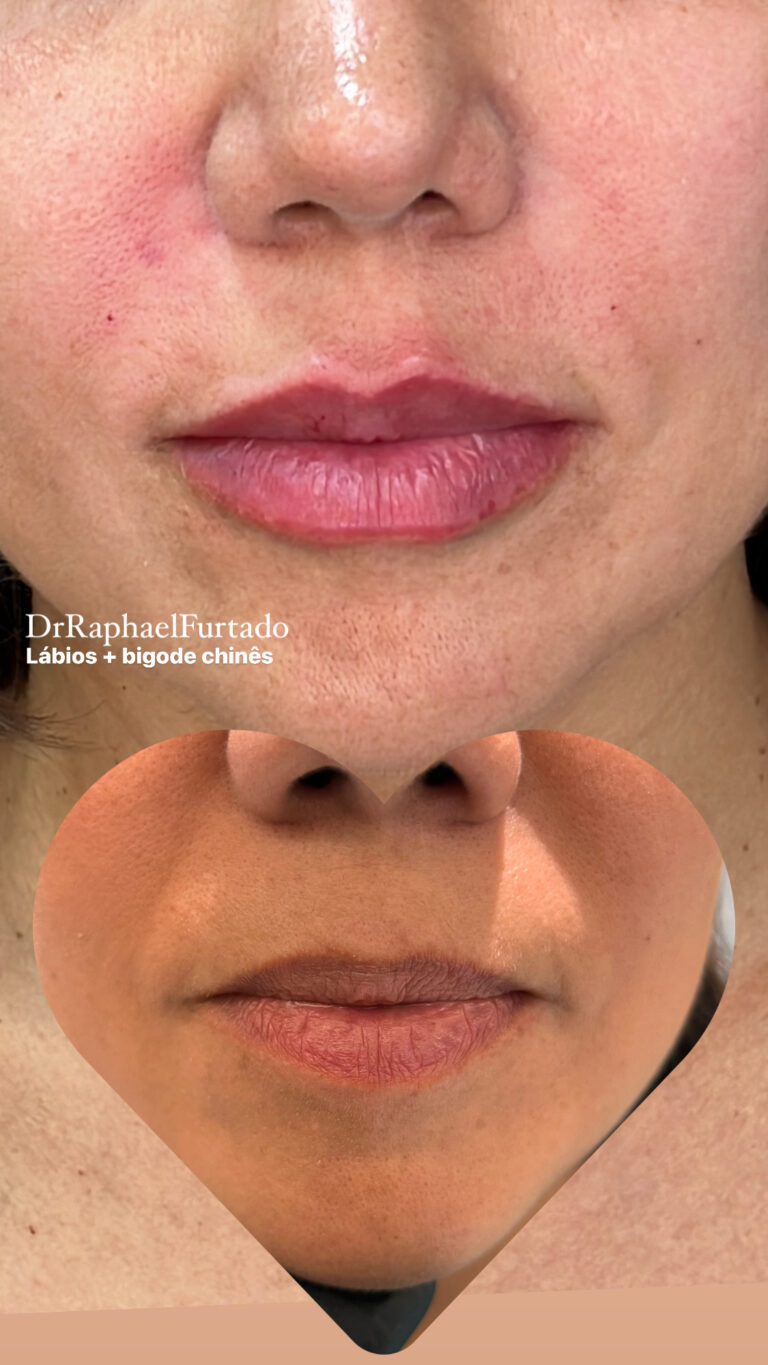 C8B9EC5E-E117-4EAE-82E8-BEE9EA9FDFDF