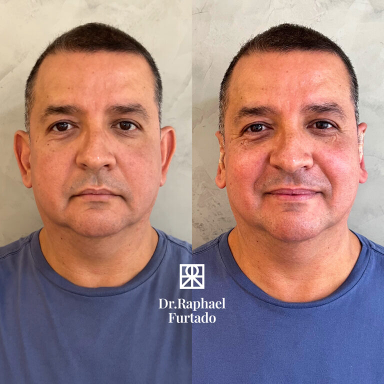 photo-output copy (1)