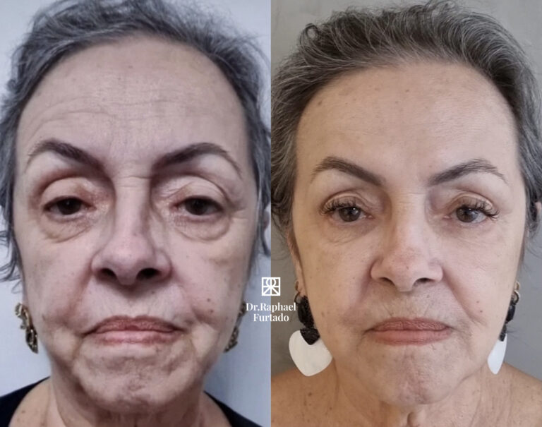 photo-output(1) copy